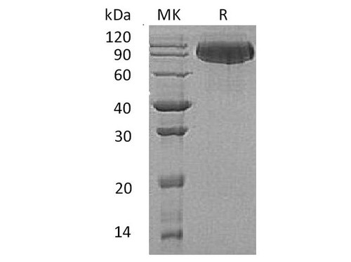 Butyrylcholinesterase/BCHE Recombinant Protein (RPES2406)