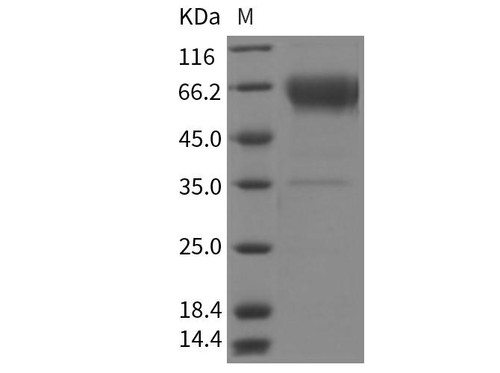 Rat BTLA/CD272 Recombinant Protein (RPES3140)