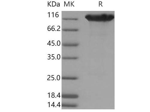 Mouse ACE2 Recombinant Protein (RPES3327)