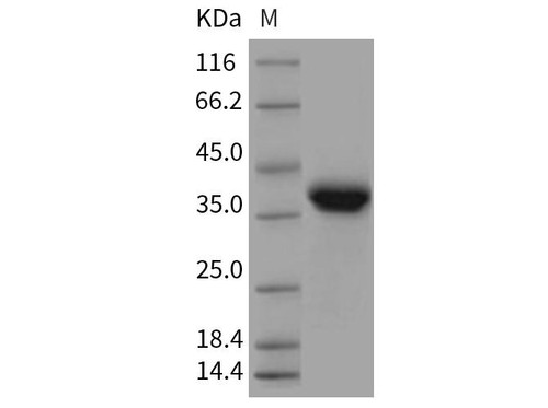 Rat EpCAM/TROP Recombinant Protein (RPES4678)