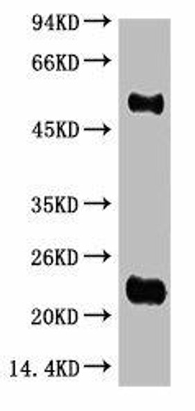 Anti-IgG HL Antibody MACO0123