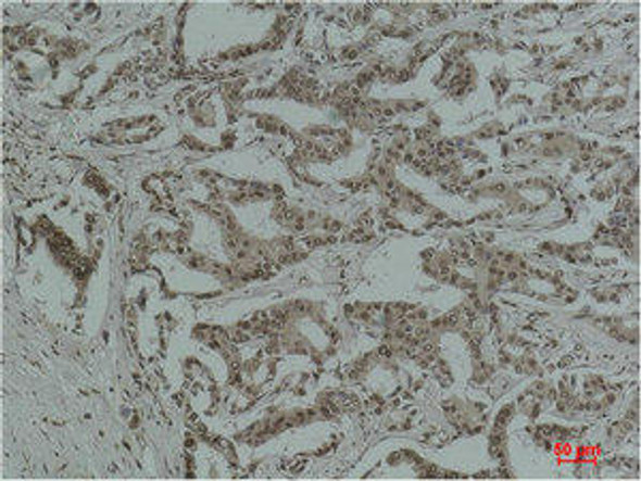 Anti-Acetyl Lysine Antibody MACO0144