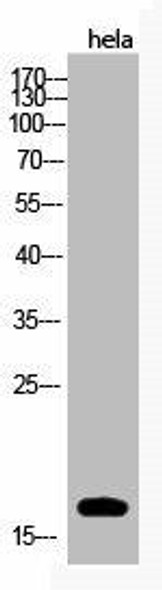 Acetyl-Histone H3 K123 Antibody PACO06084