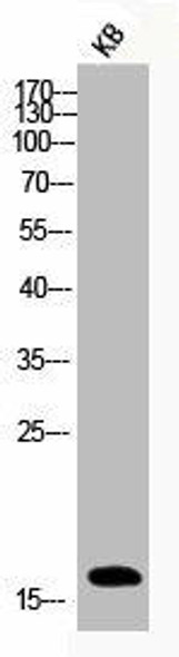 Phospho-Histone H3 S10 Antibody PACO06128