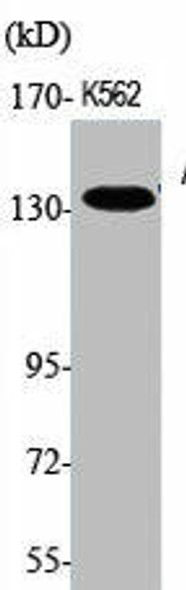 ABL1/ABL2 Antibody PACO06221