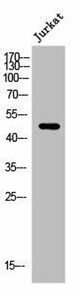 ARRDC1 Antibody PACO06265