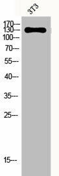 EPHA2/EPHA3/EPHA4 Antibody PACO06464