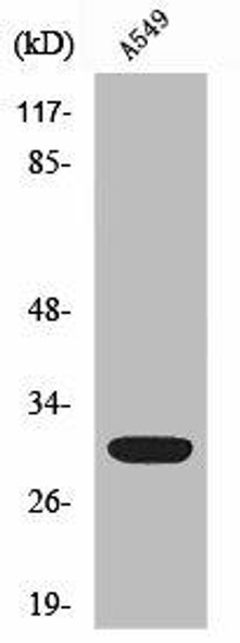 SIAH1/SIAH2 Antibody PACO06813