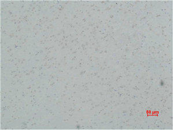 CACNG5 Antibody PACO07025