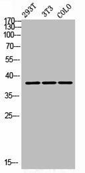 AWAT1 Antibody PACO07132