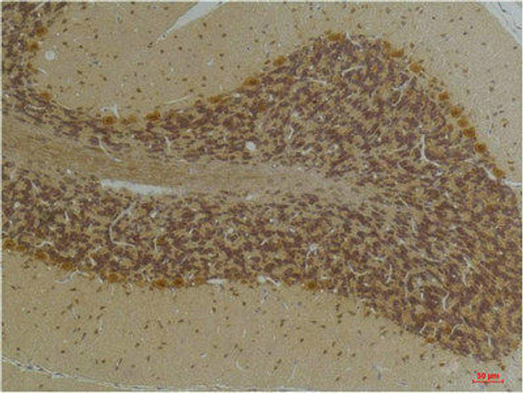 KCNN2 Antibody PACO07185