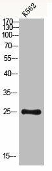 CLEC6A Antibody PACO07212