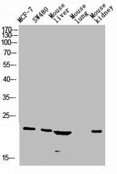 CALCA Antibody PACO07322