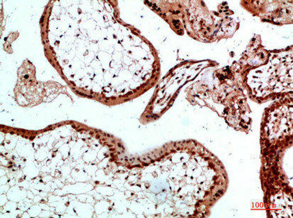 UBB/UBC/RPS27A/UBA52 Antibody PACO07395