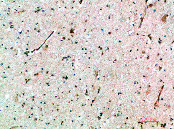 AVPR1B Antibody PACO07400