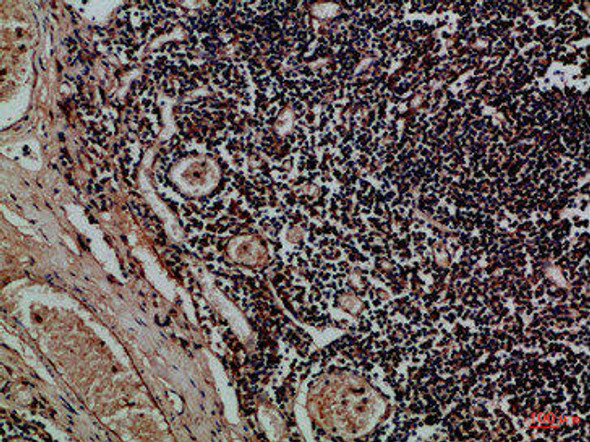 KIR2DL5A/KIR2DL5B Antibody PACO07414