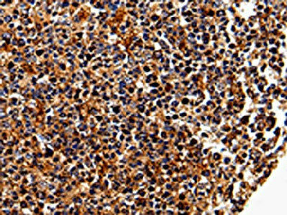 IL17RC Antibody PACO13976