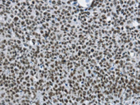 CMTM2 Antibody PACO14252