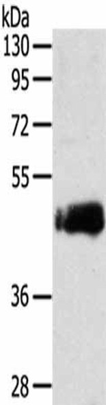 SDCCAG3 Antibody PACO14325