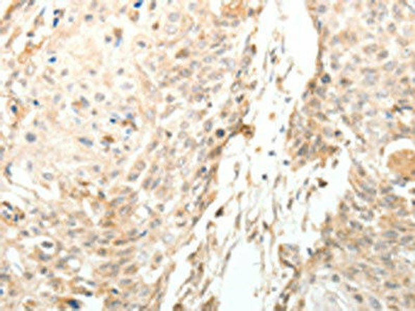 LRP12 Antibody PACO14655
