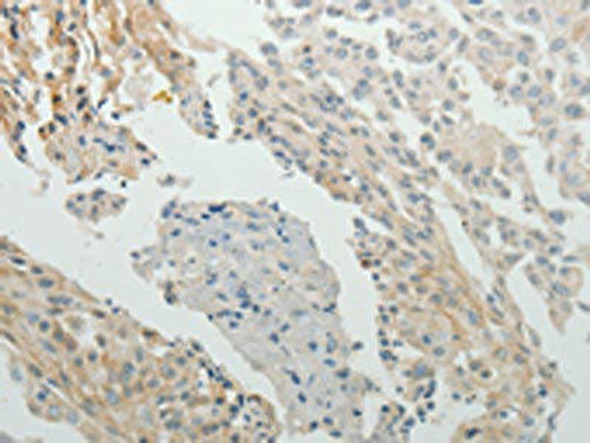 SPATA17 Antibody PACO15063
