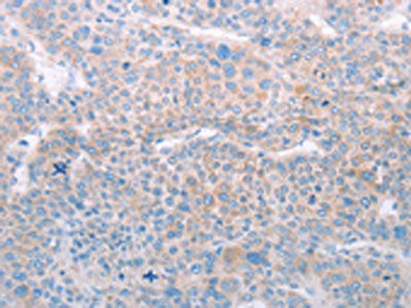 SPATA6 Antibody PACO15160