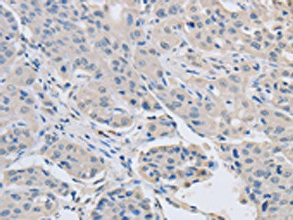 ABLIM1 Antibody PACO15240