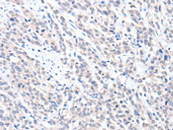 ABLIM1 Antibody PACO15241