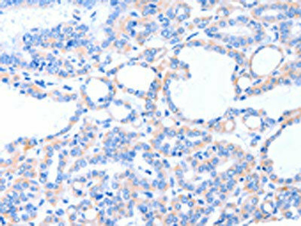 ACAD8 Antibody PACO15247