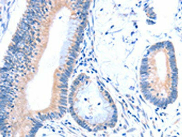 ACAD8 Antibody PACO15248