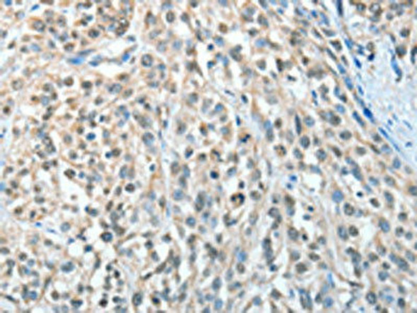 AGBL3 Antibody PACO15345