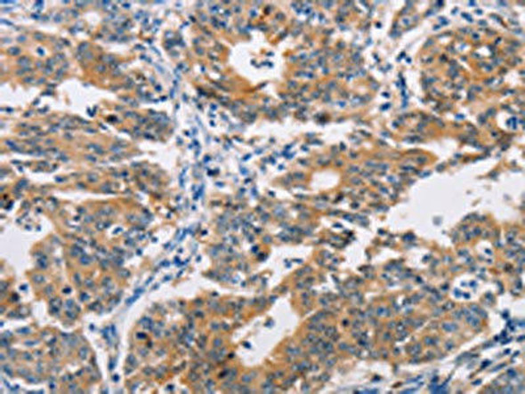 AGPAT4 Antibody PACO15349
