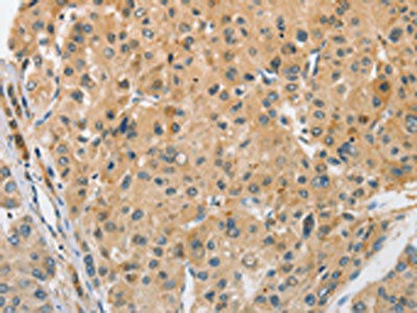 ARL8A Antibody PACO15527