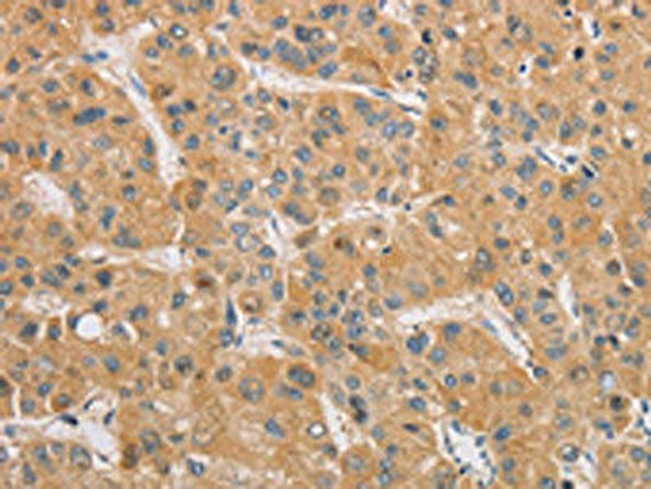 ARSK Antibody PACO15560