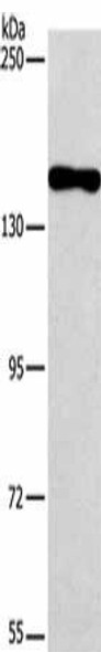 PDS5B Antibody PACO15822