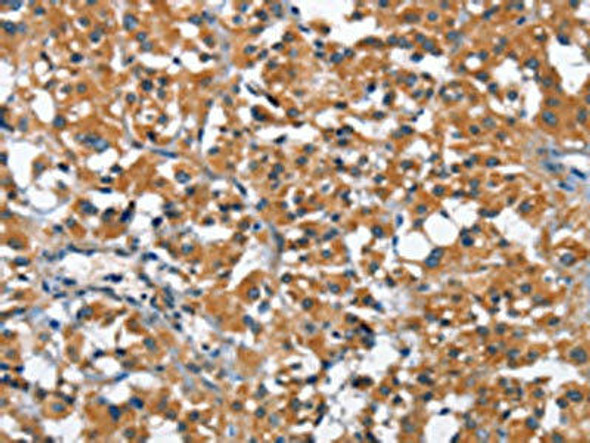 ARMCX2 Antibody PACO15825