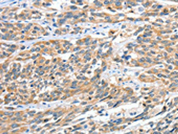 CGB Antibody PACO16020