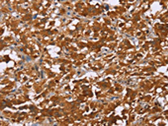 DCBLD2 Antibody PACO16144