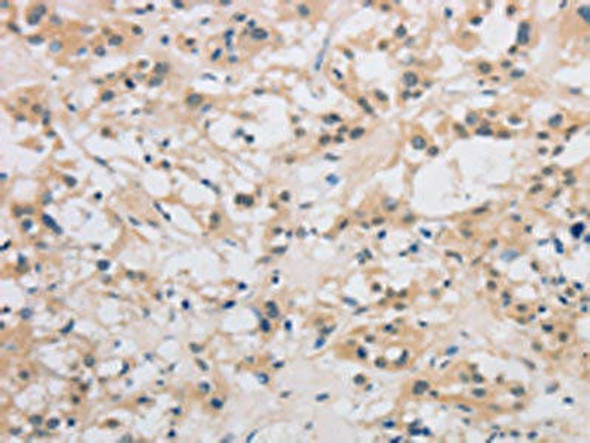 DDIT4L Antibody PACO16164
