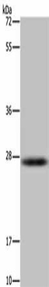 HSD17B14 Antibody PACO16493