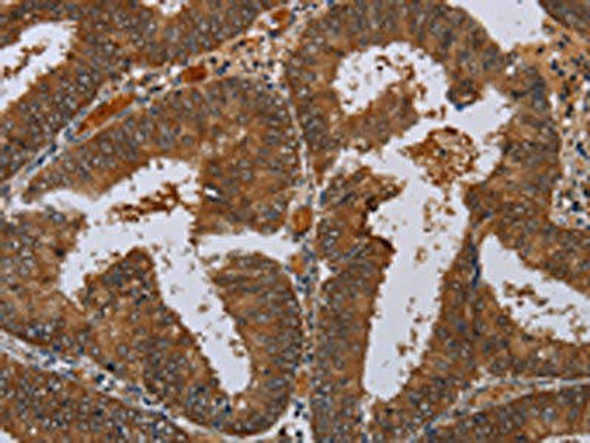 LCMT1 Antibody PACO16608
