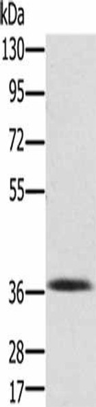 PDLIM2 Antibody PACO16850