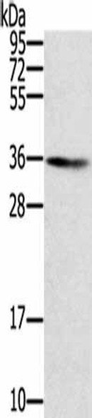SNX11 Antibody PACO17136