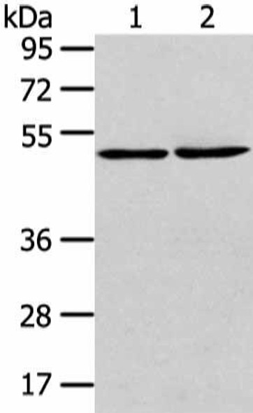 TBC1D22A Antibody PACO17211