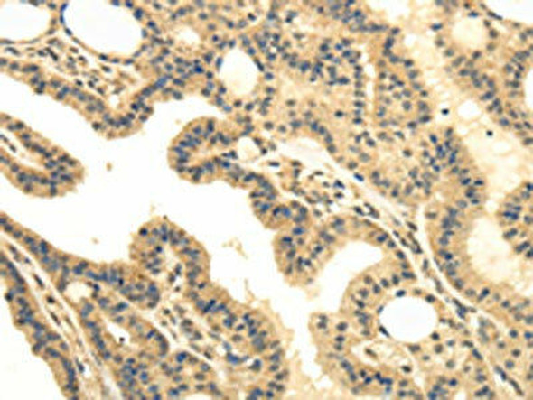 MED16 Antibody PACO17236