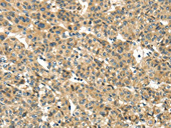 TMEM161A Antibody PACO17273