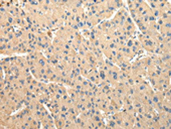 DUSP11 Antibody PACO17396