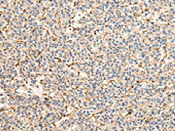 VPS41 Antibody PACO17435