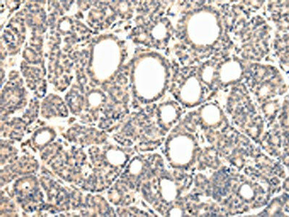 VPS37D Antibody PACO17446