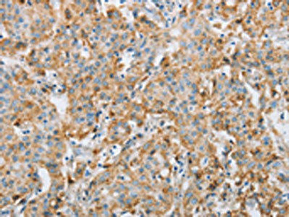 FOXF2 Antibody PACO17875